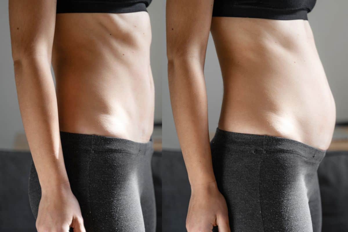 How long does diastasis recti take to improve Acton Green?