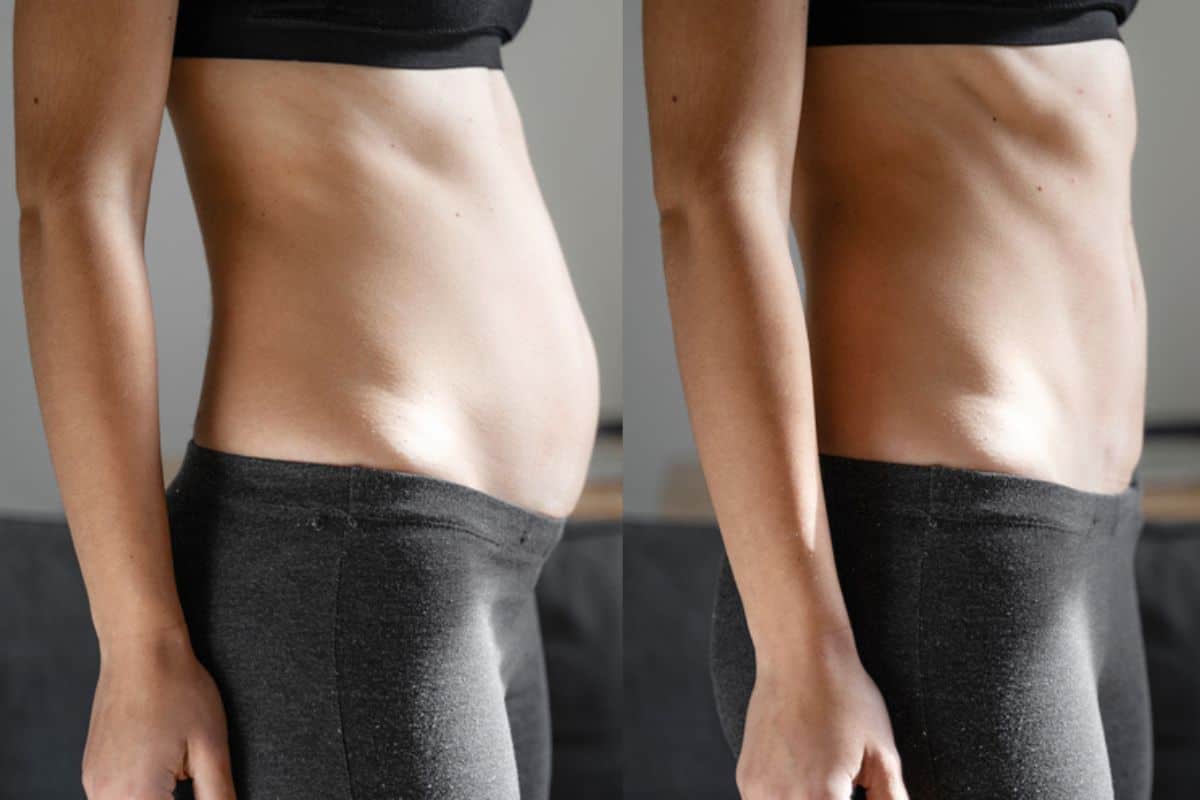 Post-Pregnancy: What Happens to Your Abdominal Muscles After Birth Acton Green