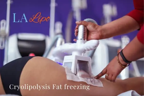 women getting fat freezing Acton Green