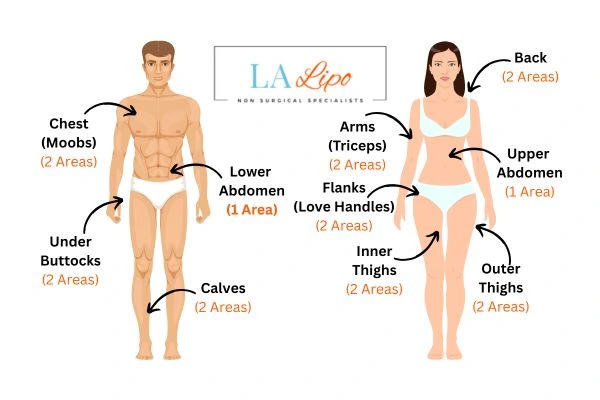 LA LIPO Cryolipolysis Areas Acton Green
