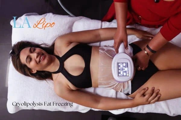 woman getting cryolipolysis Acton Green