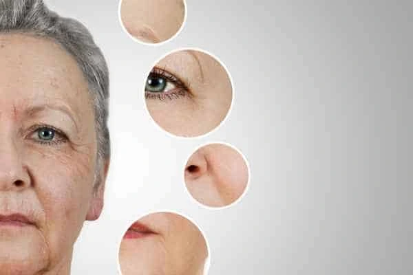 HIFU Facelift Acton Green from LA LIPO