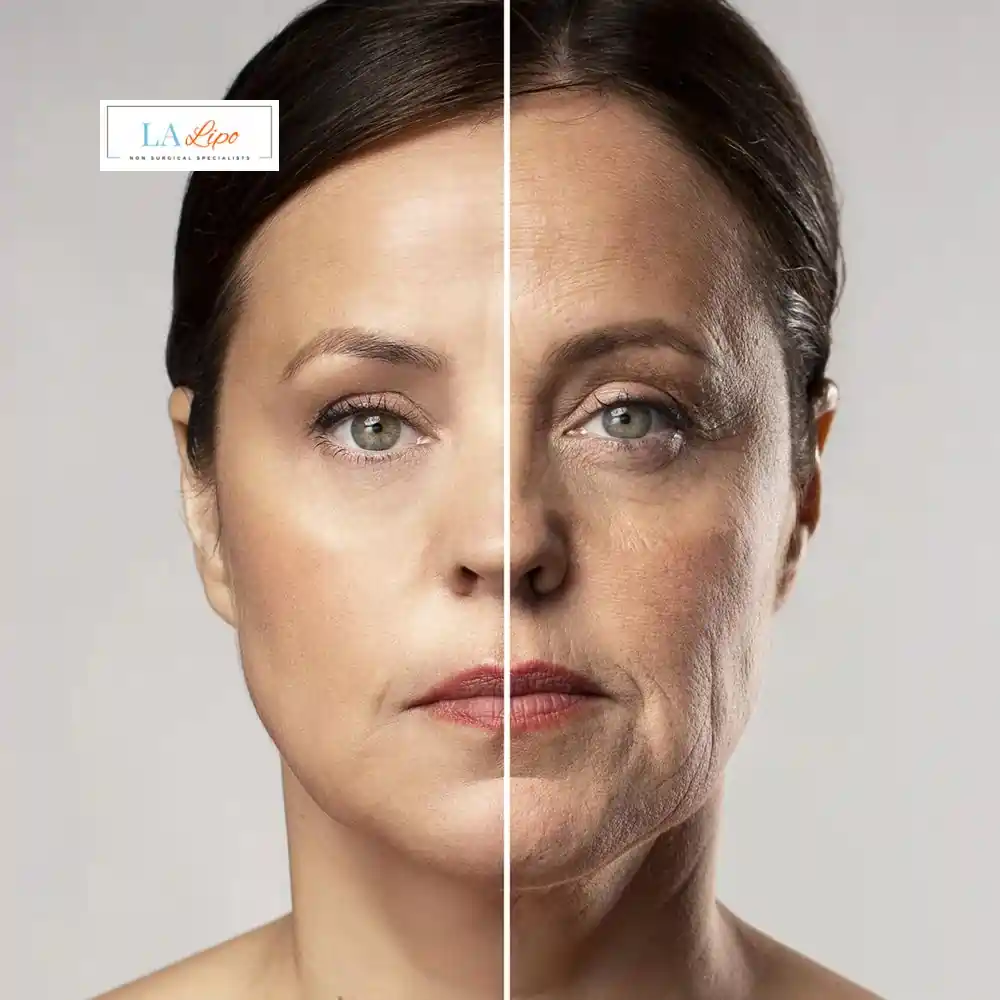 How Can You Tell If Non-Surgical Skin Tightening Is Right for You Acton Green?
