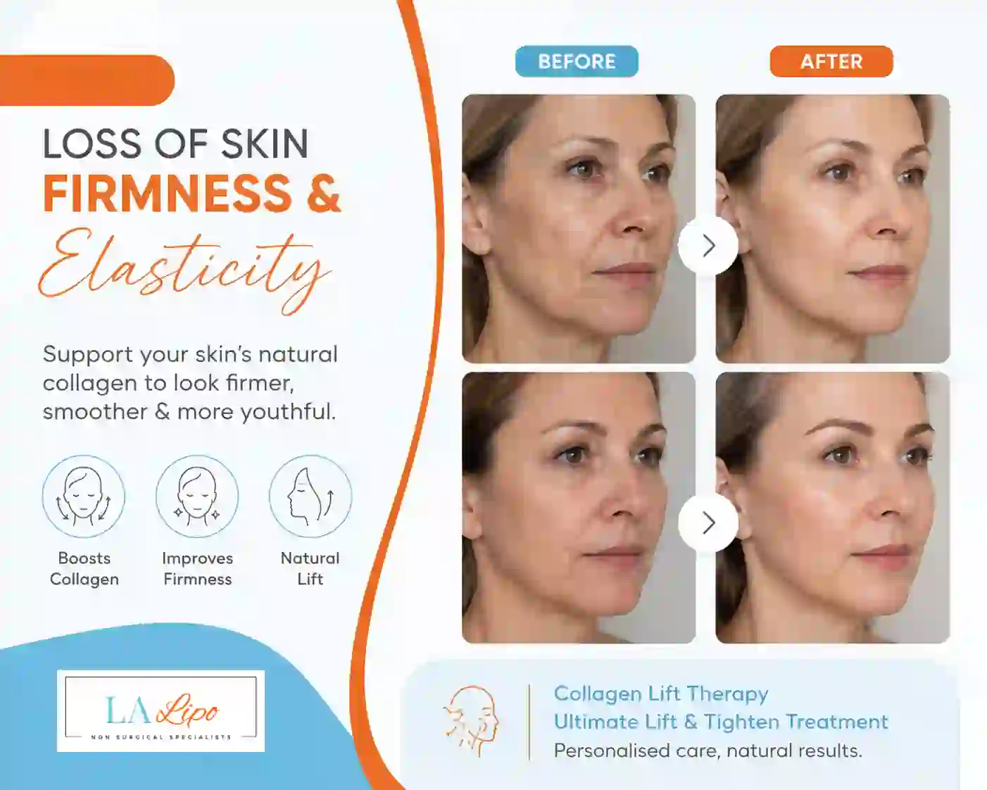 Sign #7: Loss of Skin Firmness and Elasticity Acton Green